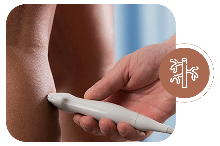 Mapeamento Vascular em Brasília | Incordis